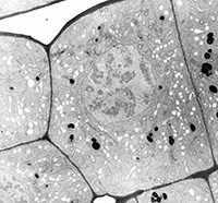 Cellule de racine de pois en microscopie électronique à transmission. Cytochimie des polysaccharides.