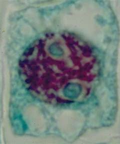 Cellule de racine de jacinthe interphasique