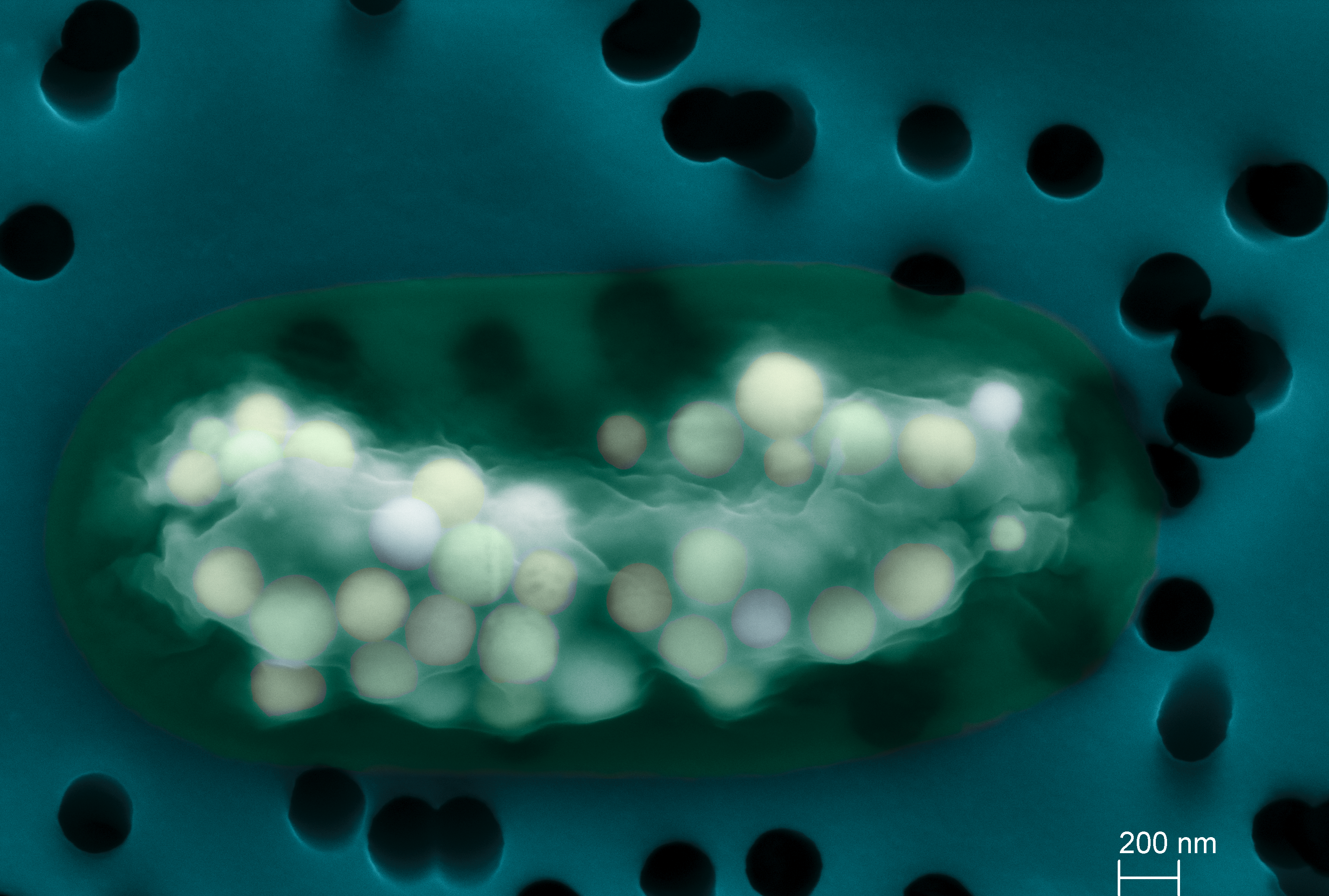 Плотное образование внутри клетки. Gloeomargarita lithophora. Цианобактерии микрофотография. Газовые везикулы цианобактерий. Вода внутри клетки.