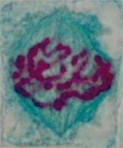 Cellule de racine de jacinthe en prometaphase