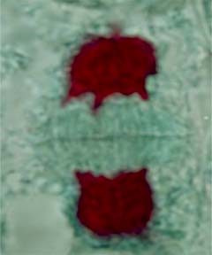 Cellule de racine de jacinthe en fin de télophase