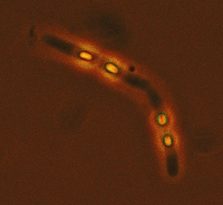 Bacille de l'antrax bacillus anthracis