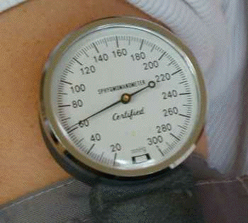 La pression du brassard devient inférieure à la PD lors de la mesure de la pression artérielle