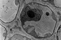 Jeune cellule de collenchyme vue en microscopie électronique à transmission (contrastant général)