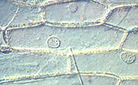 Cellule d'épiderme d'oignon vu en miscroscopie à contraste de phase