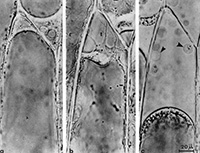 cellule epiderme oignon plasmolysee