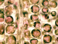 cellule plasmolysee feuille elodee