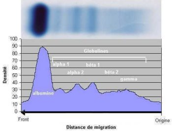 Profil densitométrique d'un sérum humain