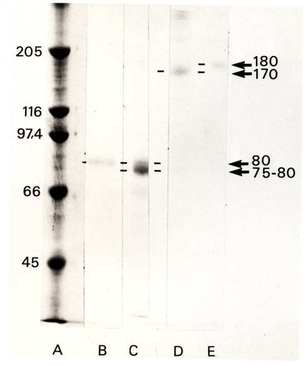 Présentation de l'électrophorèse SDS-PAGE (séparation des protéines selon  leur taille)