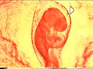 Embryon de poulet au stade 48 heures