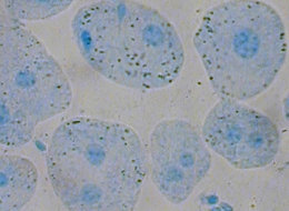 Hépatocyte de lapin coloré au bleu de méthylène, x800