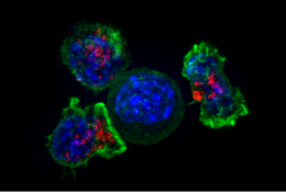 Cellule cancéreuse entourée par des lymphocytes T