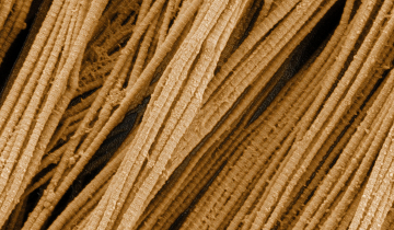 Fibres de collagène observées au microscope électronique à balayage