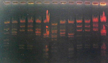 Electrophorèse ADN agarose négatif