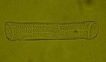 Cellule de vaisseau du xylème