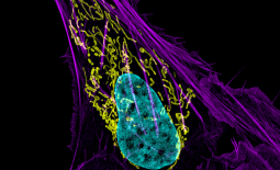 Cellule de cancer de l'os - mitochondries en jaune