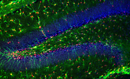 Neurones marqués GFAP et thymidine kinase