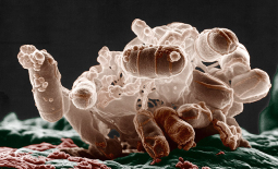 Escherichia coli