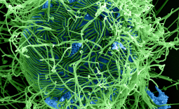 Virions d'Ebola