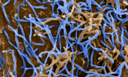 Virions d'Ebola