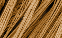 Fibres de collagène observées au microscope électronique à balayage