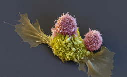 Immunothérapie des cancers