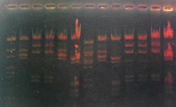 Electrophorèse ADN agarose négatif