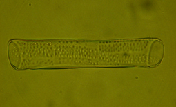 Cellule de vaisseau du xylème