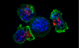 Cellule cancéreuse entourée par des lymphocytes T