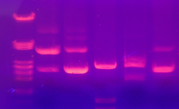 Électrophorèse d'ADN sur gel