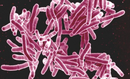 Mycobacterium tuberculosis