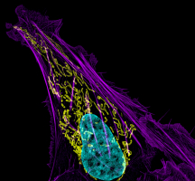 Cellule de cancer de l'os - mitochondries en jaune