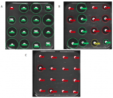 Antibiogrammes par diffusion en milieu gélosé de Klebsiella pneumoniae