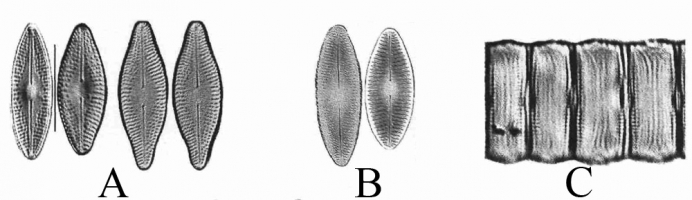 Microphotographies de Diadesmis confervacea