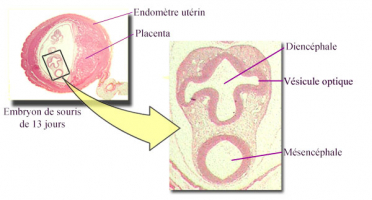 Coupe transversale d’un embryon de souris de 13 jours