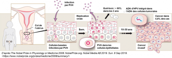 Histoire naturelle de l’infection par les papillomavirus humains (PVH) et du cancer du col de l’utérus