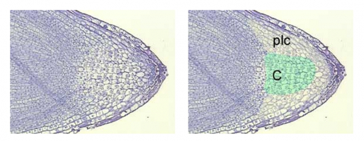 Histologie d'une coiffe racinaire