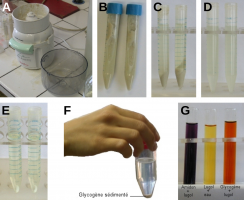 Extraction et coloration du glycogène