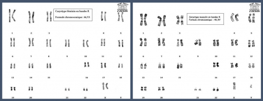 Carytotypes d'une femme et d'un homme