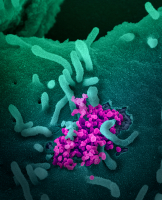 Coronavirus SARS-CoV-2