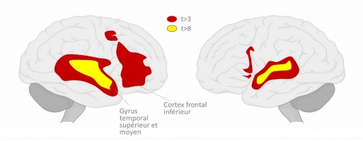 Activation du cerveau à la musique et la parole