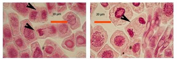 Coloration de cellules de racines d’échalote à l’aide de jus de myrtilles: anaphase et télophase