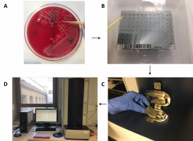 Les étapes de l’identification par spectrométrie de masse MALDI-TOF