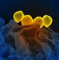 Streptococcus pyogenes