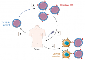 Mode d’emploi des cellules CAR-T