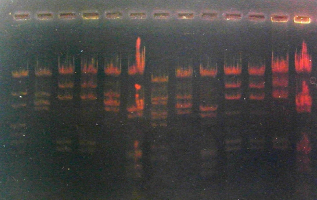 Electrophorèse ADN agarose négatif