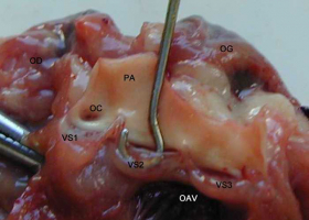 Détail du départ de l'aorte 