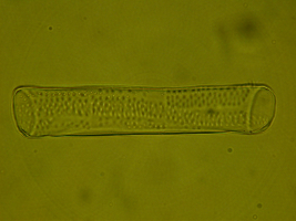 Cellule de vaisseau du xylème