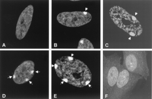 Détection des corpuscules de Barr par immunofluorescence