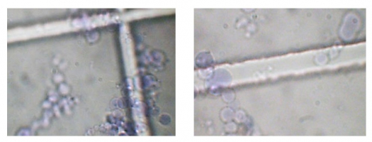 Coacervats observés en microscopie optique après coloration au bleu de méthylène